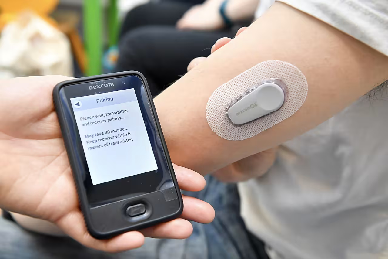Exploring Needleless Glucose Monitoring: Technology and Benefits